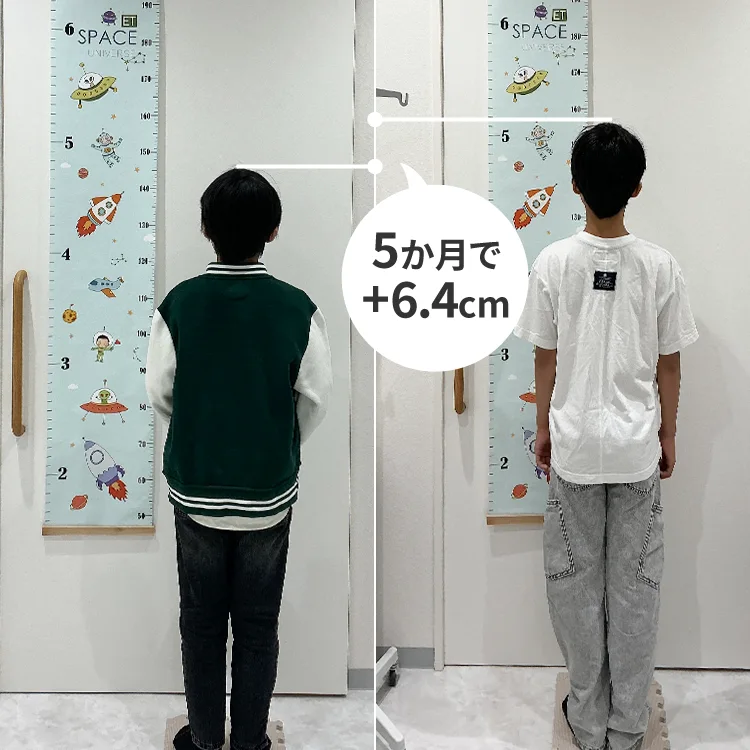 13歳の男の子が成長ホルモン補充療法を5か月受けた、治療前と治療後の身長の比較