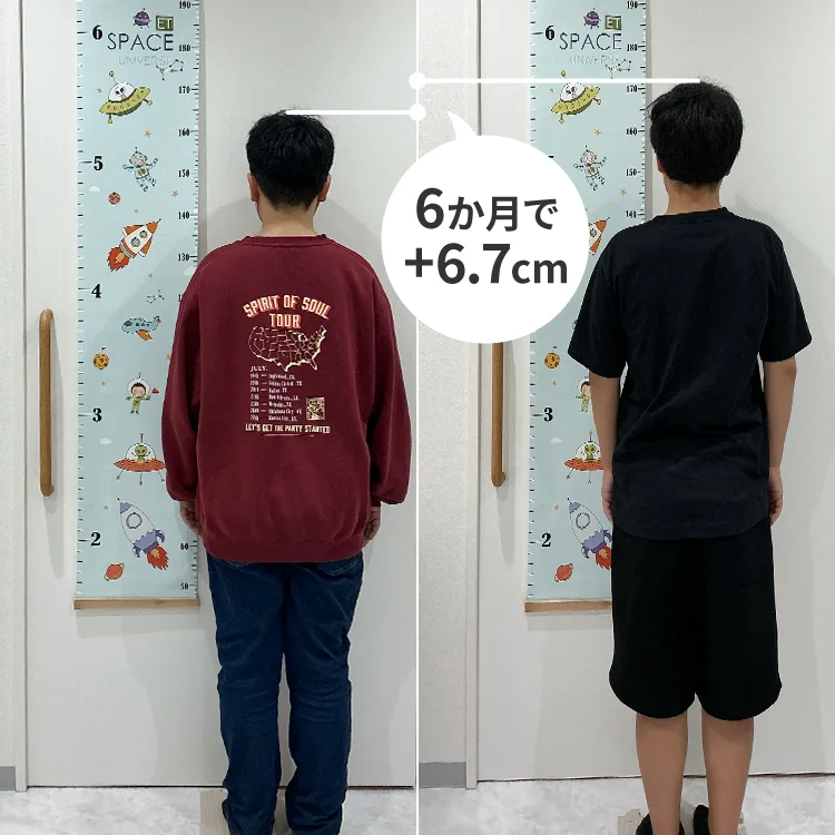 13歳の男の子が成長ホルモン補充療法を6か月受けた、治療前と治療後の身長の比較